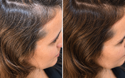 Barros vegetales para cubrir las canas en Granada: color natural sin amoníaco