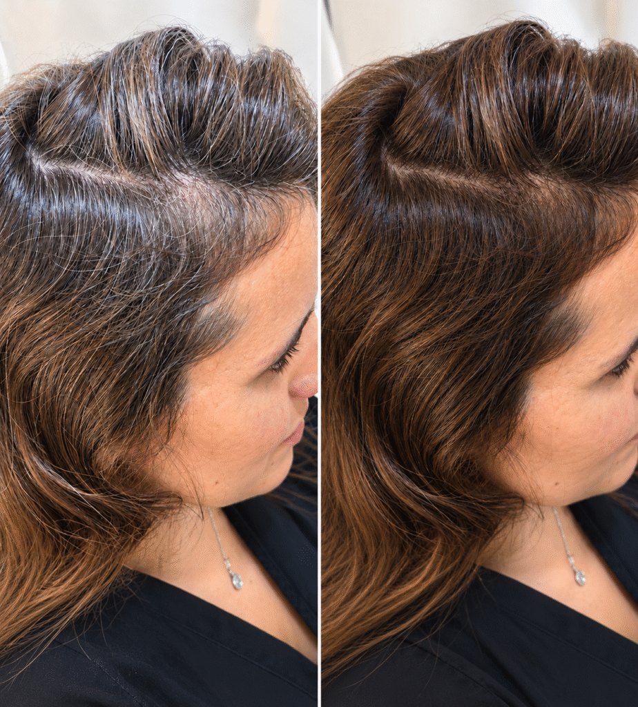 Antes y después de coloración con barros vegetales para cubrir las canas en TAO Estilistas, Granada.
